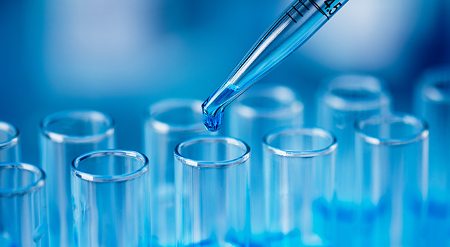 Photo: Test tube and pipette in medical lab